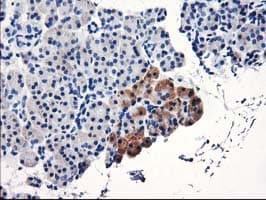 TBC1D21 Antibody (clone OTI7G10)