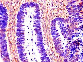 CTSB / Cathepsin B Antibody
