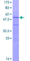 Human C1QTNF6 / CTRP6 Protein (Recombinant GST)
