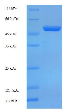 Human OXNAD1 Protein (Recombinant His-SUMO)