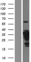 Human ZWINT Protein (Over-Expression Lysate Myc-DDK (Flag))