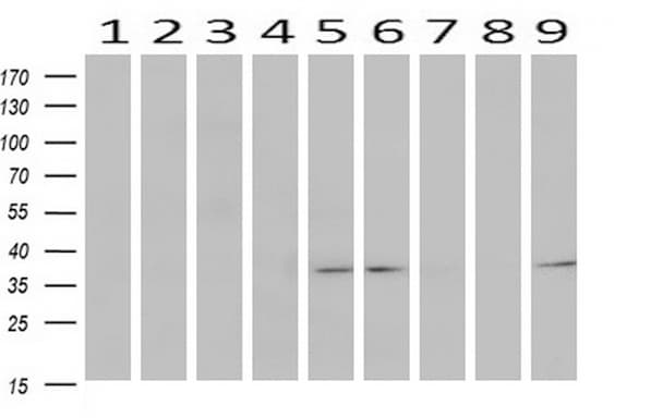 TP53I3 / PIG3 Antibody (clone OTI3B11, Carrier-free)