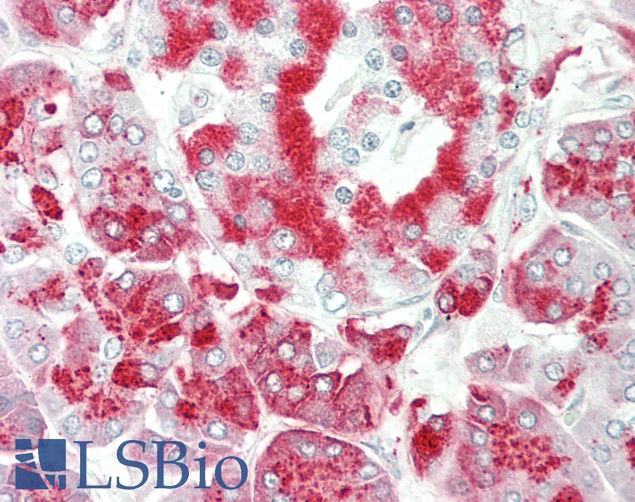 IHC-plus™ ADGRE1 / EMR1 Antibody (aa811-860)