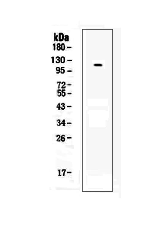 HAVCR1 / KIM-1 Antibody