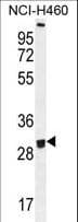 OR2B11 Antibody (aa248-276)