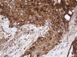 PAI-RBP1 / SERBP1 Antibody (clone OTI2F6)