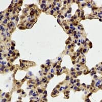 Polyclonal Rabbit anti-Human PADI4 / PAD4 Antibody (IHC, IF, WB)
