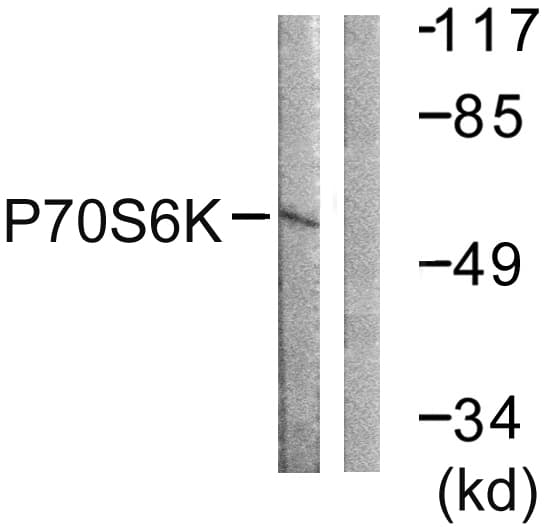 RPS6KB1 / P70S6K / S6K Antibody (aa195-244)