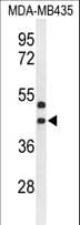 GPR17 Antibody (aa230-258)