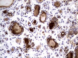 NBN / Nibrin Antibody (clone OTI6H7)