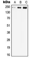 CACNA1C / Cav1.2 Antibody (Internal)