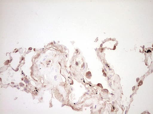 SPP1 / Osteopontin Antibody (aa17-314, clone OTI5E4)