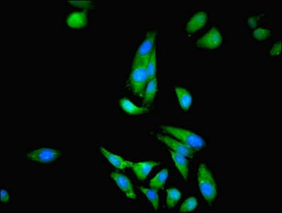 CKB / Creatine Kinase BB Antibody (aa2-270)