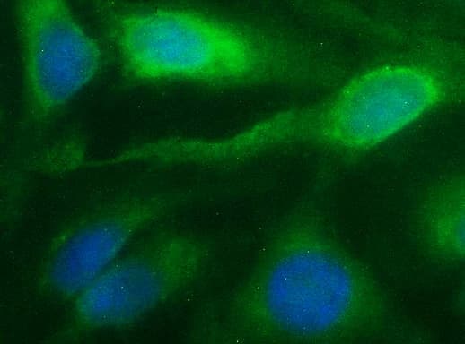 Monoclonal Mouse anti-Human NFKBIA / IKB Alpha / IKBA Antibody (clone OTI1D4, IF, WB)