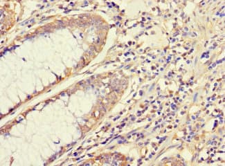 APG5 / ATG5 Antibody