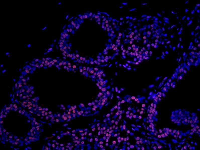 IHC-plus™ Polyclonal Rabbit anti-Human MATR3 / Matrin 3 Antibody (aa800-C-term, IHC, IF)