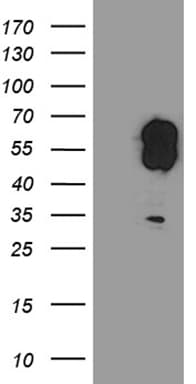 EVX1 Antibody (aa1-244, clone OTI1F8)