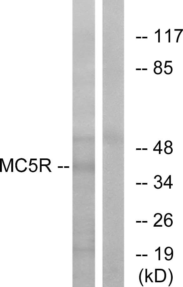 MC5R / MC5 Receptor Antibody (aa271-320)