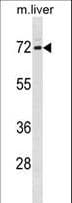 FXR1 Antibody (aa37-66)