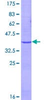 Human EMP2 Protein (Recombinant GST)