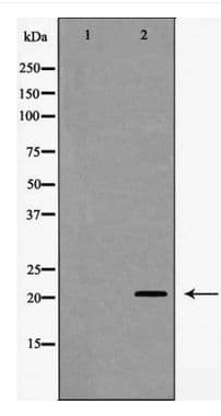Polyclonal Rabbit anti-Human TTF / RHOH Antibody (IF, WB)