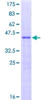 Human SRP19 Protein (Recombinant GST)