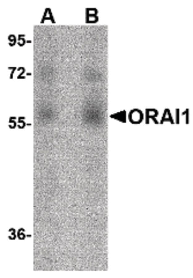 Monoclonal Mouse anti-Human TMEM142A / ORAI1 Antibody (clone 3F6H5, IHC, IF, WB)
