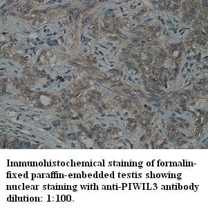 Polyclonal Rabbit anti-Human PIWIL3 Antibody (Internal, IHC)