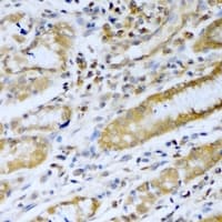 PSMB5 Antibody