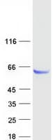 Human PPM1J Protein (Recombinant Myc-DDK (Flag))