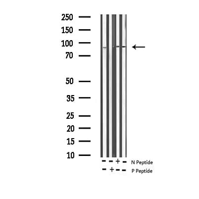 Polyclonal Rabbit anti-Human SP1 Antibody (phospho-Thr739, IHC, IF, WB)