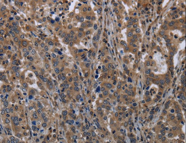 TSC22D3 / GILZ Antibody