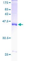 Human SOD1 / Cu-Zn SOD Protein (Recombinant GST)