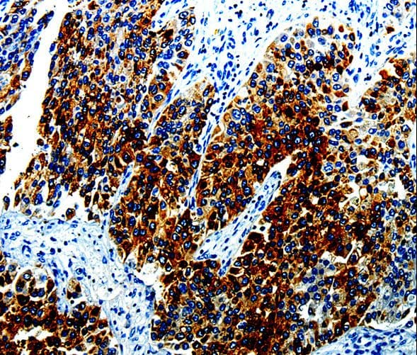 Polyclonal Rabbit anti-Human AGR2 Antibody (IHC, WB)