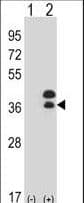 DLX5 Antibody (aa100-128)