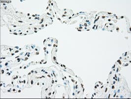 CHEK2 / CHK2 Antibody (clone OTI5C4)