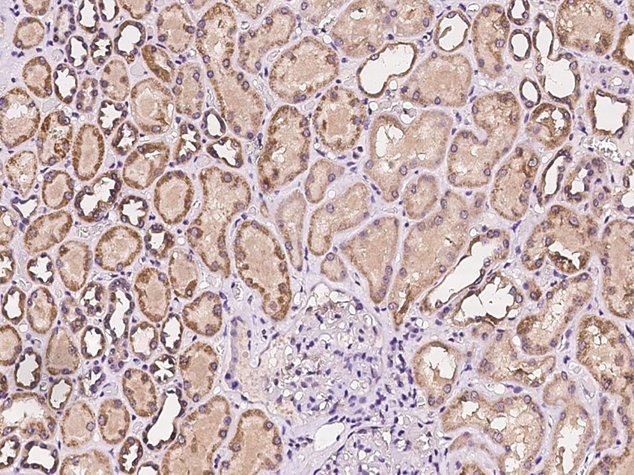 ZNF391 Antibody