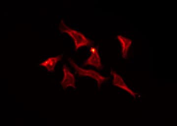 CNNM2 Antibody