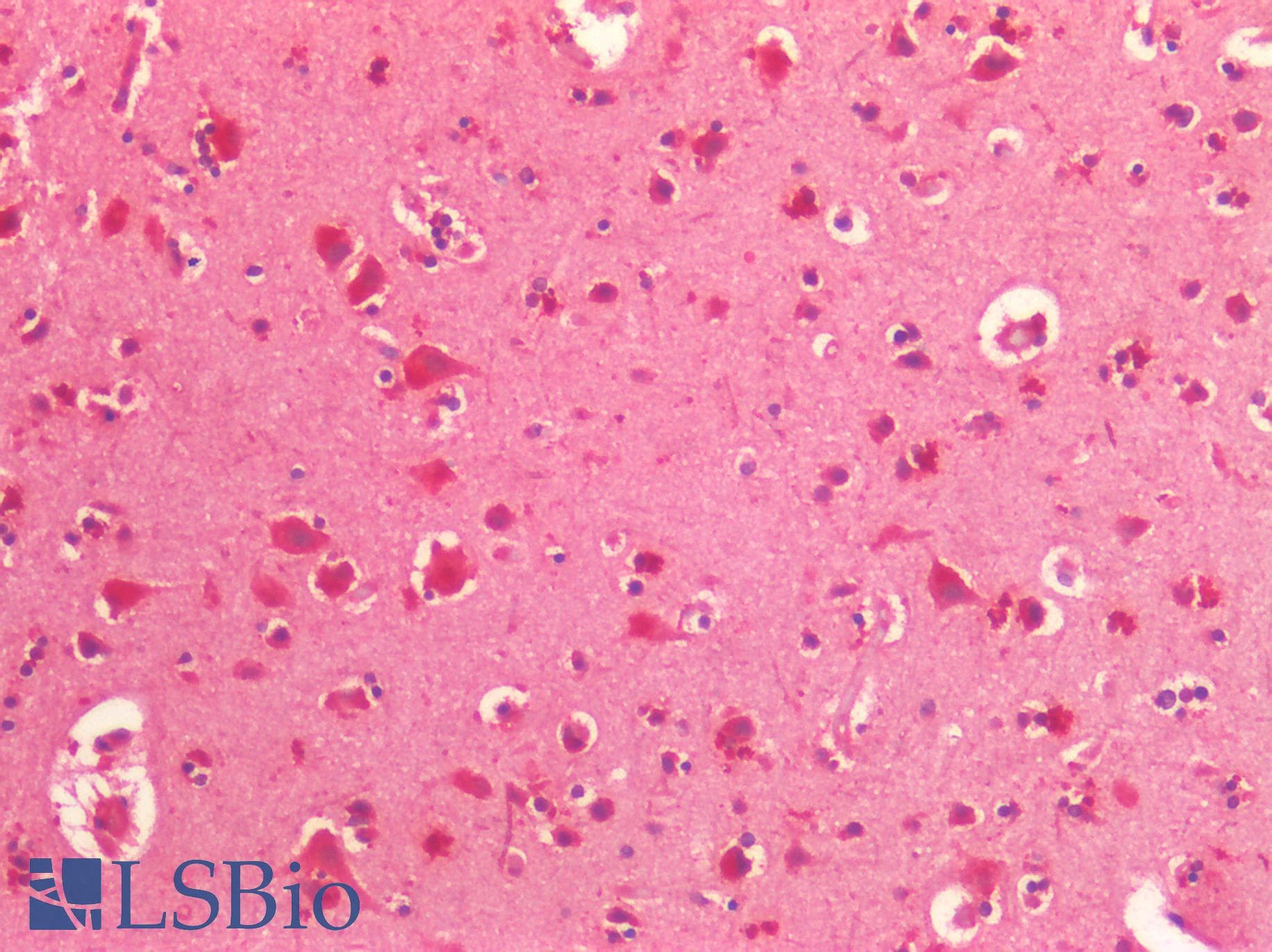 IHC-plus™ Polyclonal Rabbit anti-Human CKAP5 / ch-TOG Antibody (IHC, IF, WB)