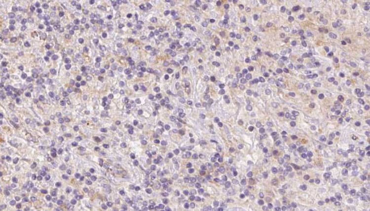 Polyclonal Rabbit anti-Human UQCRFS1 Antibody (IHC, IF, WB)