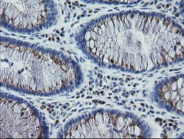 RAB30 Antibody (clone OTI3E7)