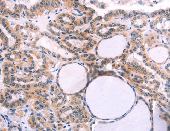 IL1RL1 Antibody
