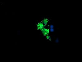 LCMT1 Antibody (clone OTI 1G5)