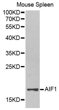 Polyclonal Rabbit anti-Human AIF1 / IBA1 Antibody (IHC, IF, WB)