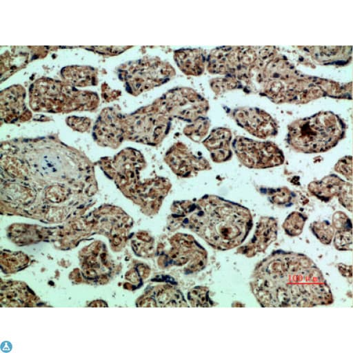 KDR / VEGFR2 / FLK1 Antibody