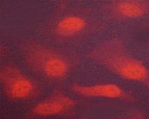 Polyclonal Rabbit anti-Human CHEK2 / CHK2 Antibody (phospho-Thr383, IHC, IF, WB)