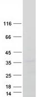 Human LPP3 / PPAP2B Protein (Recombinant Myc-DDK (Flag))