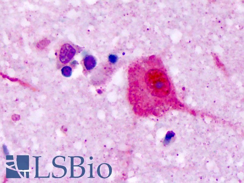 IHC-plus™ V1RL1 / VN1R1 Antibody (Extracellular Domain)