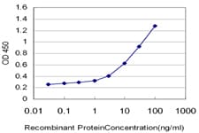 PRKAA2 / AMPK Alpha 2 Antibody (clone 1G8)