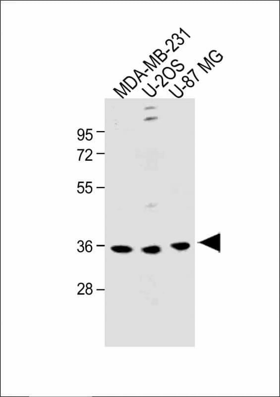 OR6C3 Antibody (Internal)